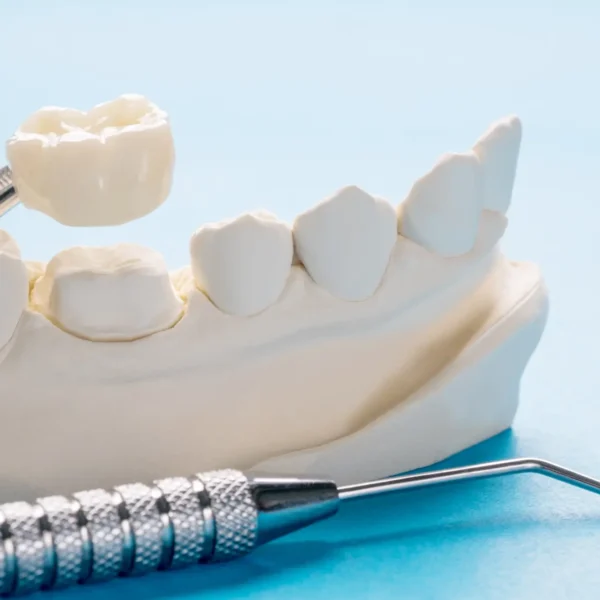 Why Some Children Need A Crown Instead Of A Filling On A Baby Molar