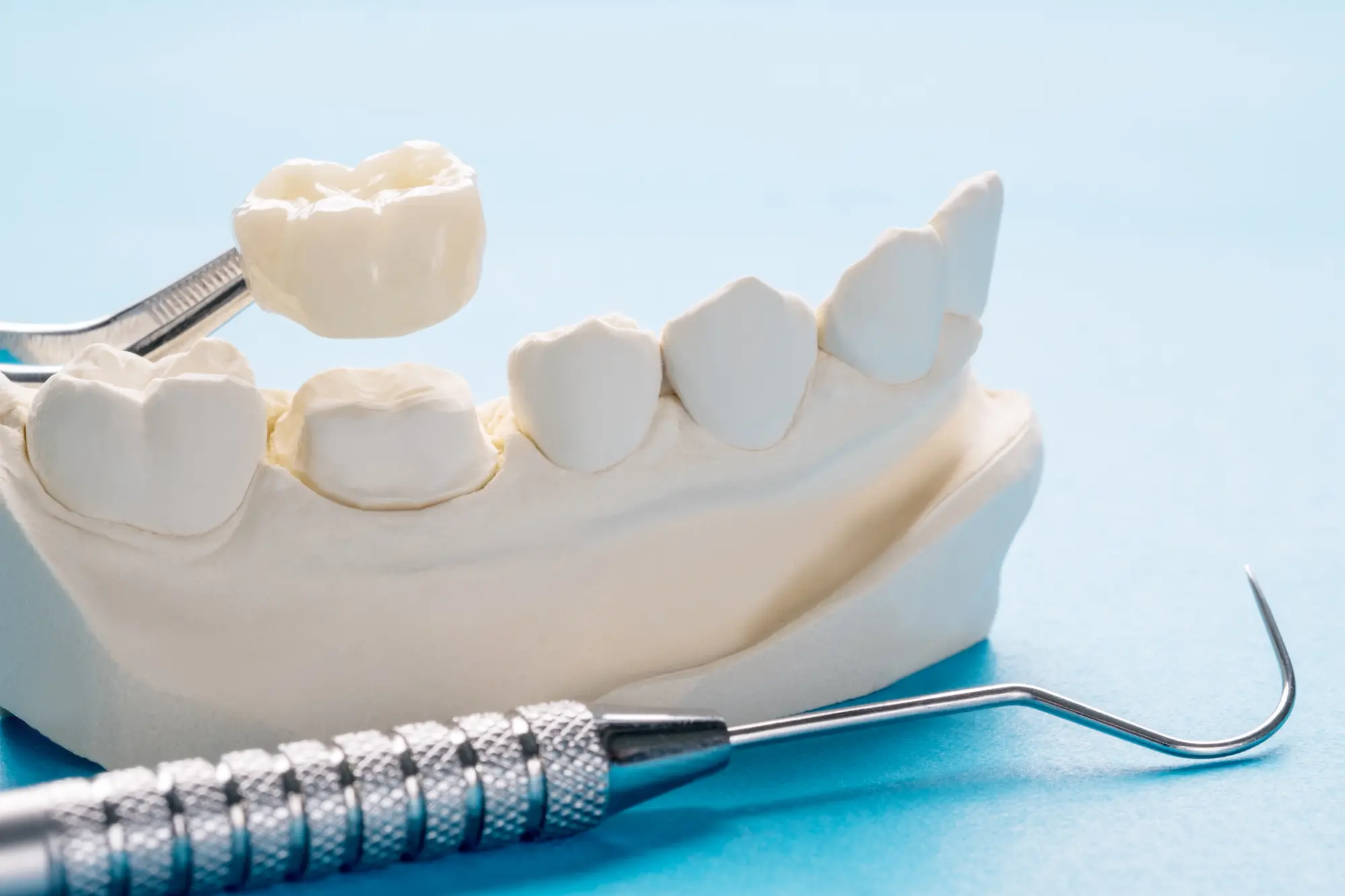 Why Some Children Need A Crown Instead Of A Filling On A Baby Molar